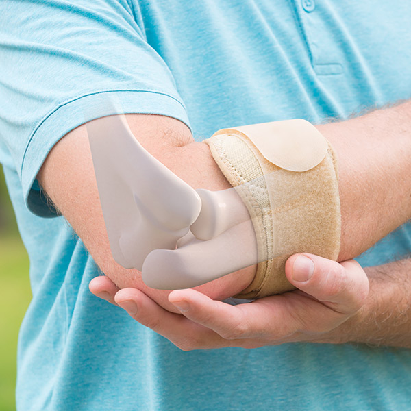 Tennis Elbow: What It Is And How To Cope With It